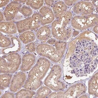 Immunohistochemistry: TSEN54 Antibody [NBP2-30377]