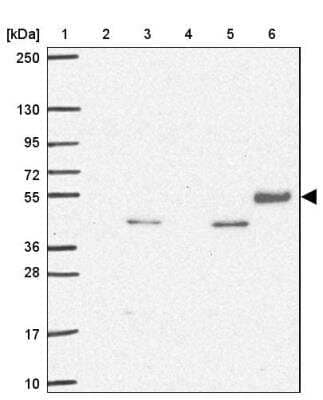 Western Blot: TSEN54 Antibody [NBP2-30377]