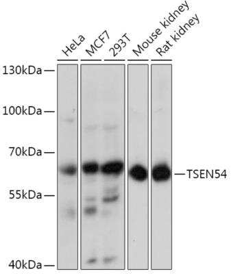 Western Blot: TSEN54 AntibodyAzide and BSA Free [NBP2-94599]