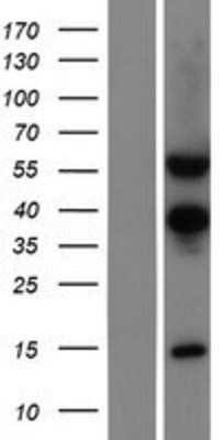 Western Blot: TSEN54 Overexpression Lysate [NBP2-04492]