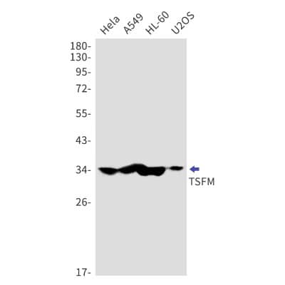 Western Blot: TSFM Antibody (S06-6H3) [NBP3-19981]