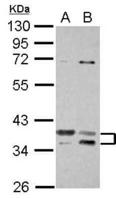 Western Blot: TSFM Antibody [NBP2-20746]