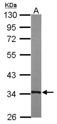 Western Blot: TSFM Antibody [NBP2-20747]