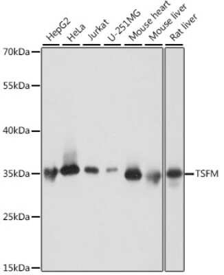 Western Blot: TSFM AntibodyAzide and BSA Free [NBP2-93796]