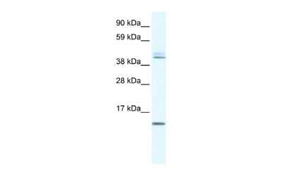 Western Blot: TSFM Antibody [NBP3-10952]