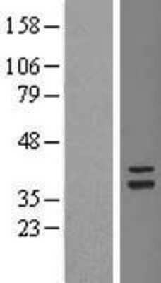 Western Blot: TSFM Overexpression Lysate [NBL1-17357]