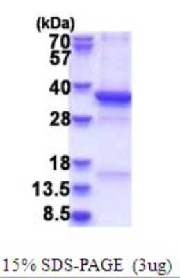 SDS-PAGE: Recombinant Human TSFM Protein [NBP2-51704]