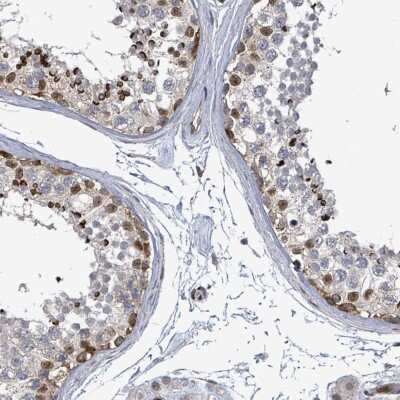 Immunohistochemistry-Paraffin: TSG-9 Antibody [NBP2-13495]
