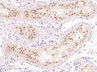 Immunohistochemistry-Paraffin: TSG-9 Antibody [NBP3-05875]