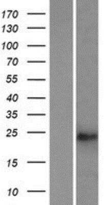 Western Blot: TSG-9 Overexpression Lysate [NBP2-08930]