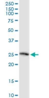 Western Blot: TSG Antibody (2F3) [H00057045-M07]