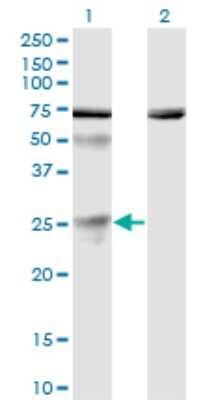 Western Blot: TSG Antibody (6E6) [H00057045-M01]