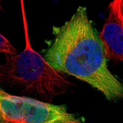 Immunocytochemistry/ Immunofluorescence: TSG Antibody [NBP1-80660]