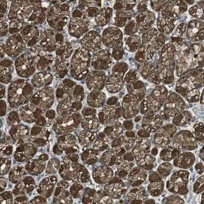 Immunohistochemistry-Paraffin: TSG Antibody [NBP1-80660]