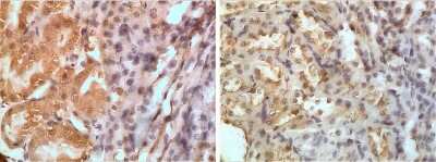 Immunohistochemistry-Paraffin: TSG Antibody (RM0140-7D19) - Azide and BSA Free [NBP1-22516]