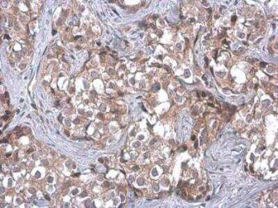 Immunohistochemistry-Paraffin: TSG101 Antibody (4A10) [NB200-112]