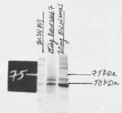 Western Blot: TSG101 Antibody (4A10) [NB200-112]