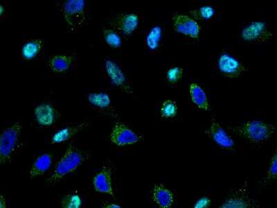 Immunocytochemistry/ Immunofluorescence: TSG101 Antibody [NBP2-98994]