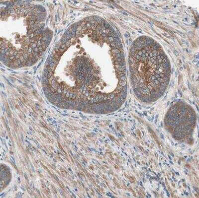 Immunohistochemistry-Paraffin: TSG101 Antibody [NBP1-80659]