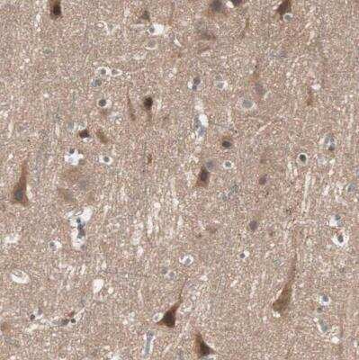 Immunohistochemistry-Paraffin: TSG101 Antibody [NBP1-80659]