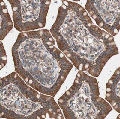 Immunohistochemistry-Paraffin: TSG101 Antibody [NBP1-80659]