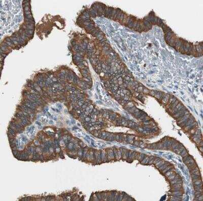 Immunohistochemistry-Paraffin: TSG101 Antibody [NBP1-80659]