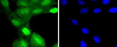 Immunocytochemistry/ Immunofluorescence: TSG101 Antibody (JJ0900) [NBP2-67884]