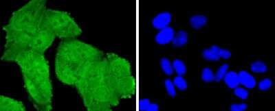 Immunocytochemistry/ Immunofluorescence: TSG101 Antibody (JJ0900) [NBP2-67884]