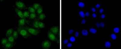 Immunocytochemistry/ Immunofluorescence: TSG101 Antibody (JJ0900) [NBP2-67884]