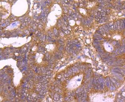 Immunohistochemistry-Paraffin: TSG101 Antibody (JJ0900) [NBP2-67884]