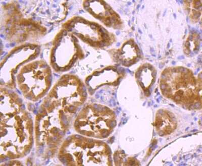 Immunohistochemistry-Paraffin: TSG101 Antibody (JJ0900) [NBP2-67884]