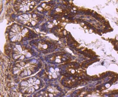 Immunohistochemistry-Paraffin: TSG101 Antibody (JJ0900) [NBP2-67884]