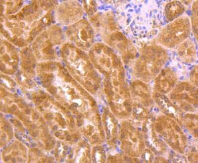 Immunohistochemistry-Paraffin: TSG101 Antibody (JJ0900) [NBP2-67884]
