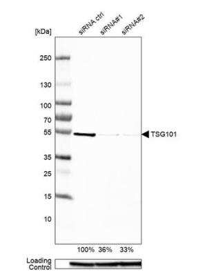 Western Blot: TSG101 Antibody [NBP1-80659]