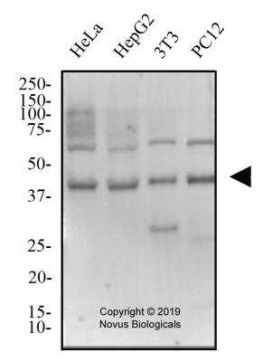 Western Blot: TSG101 AntibodyBSA Free [NBP2-77452]