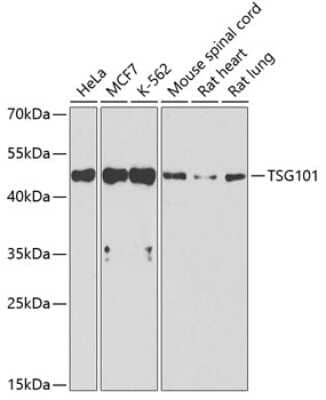 Western Blot: TSG101 AntibodyAzide and BSA Free [NBP2-94822]