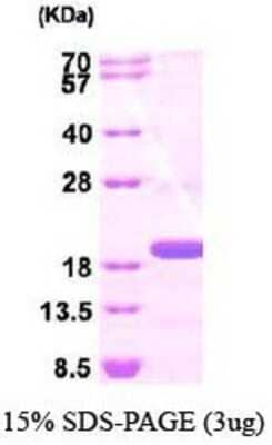 SDS-PAGE: Recombinant Human TSG101 His Protein [NBP1-44489]