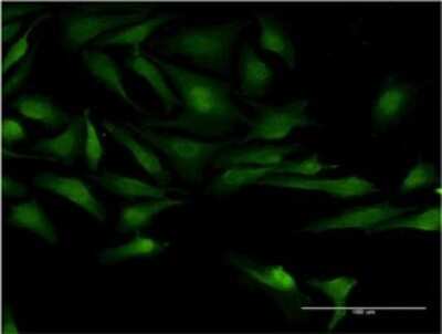Immunocytochemistry/ Immunofluorescence: TSGA10 Antibody (6E8) [H00080705-M08]
