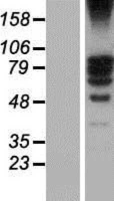 Western Blot: TSGA10 Overexpression Lysate [NBP2-04801]