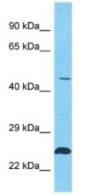 Western Blot: TSGA10IP Antibody [NBP3-09900]