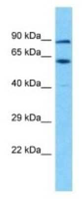 Western Blot: TSGA10IP Antibody [NBP3-09901]