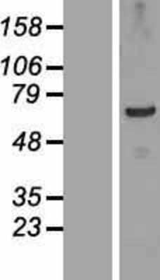 Western Blot: TSGA10IP Overexpression Lysate [NBP2-05316]