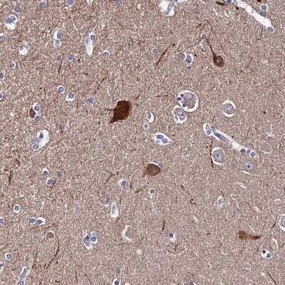 Immunohistochemistry-Paraffin: TSGA14 Antibody [NBP1-92538]