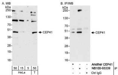 Western Blot: TSGA14 Antibody [NB100-93339]