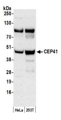 Western Blot: TSGA14 Antibody [NB100-93339]