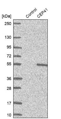 Western Blot: TSGA14 Antibody [NBP1-92538]