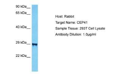 Western Blot: TSGA14 Antibody [NBP2-86016]