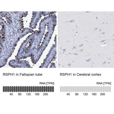 Immunohistochemistry-Paraffin: TSGA2 Antibody [NBP1-89839]