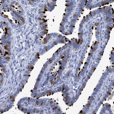 Immunohistochemistry-Paraffin: TSGA2 Antibody [NBP1-89839]