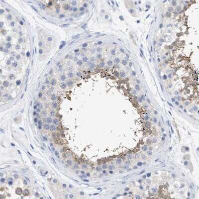 Immunohistochemistry-Paraffin: TSGA2 Antibody [NBP1-89839]